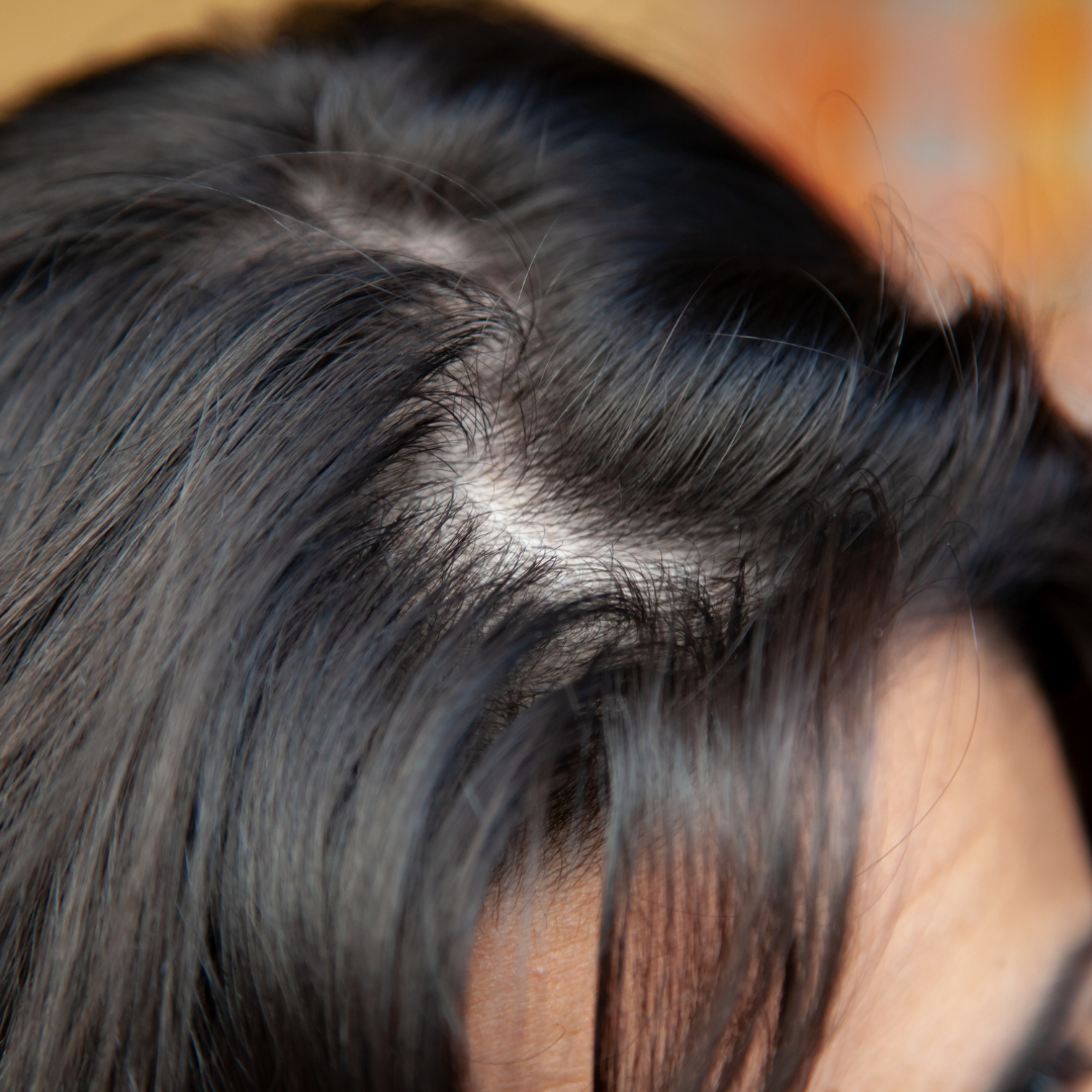 How to Fix Greasy Hair With Baby Powder Urban Woman Magazine