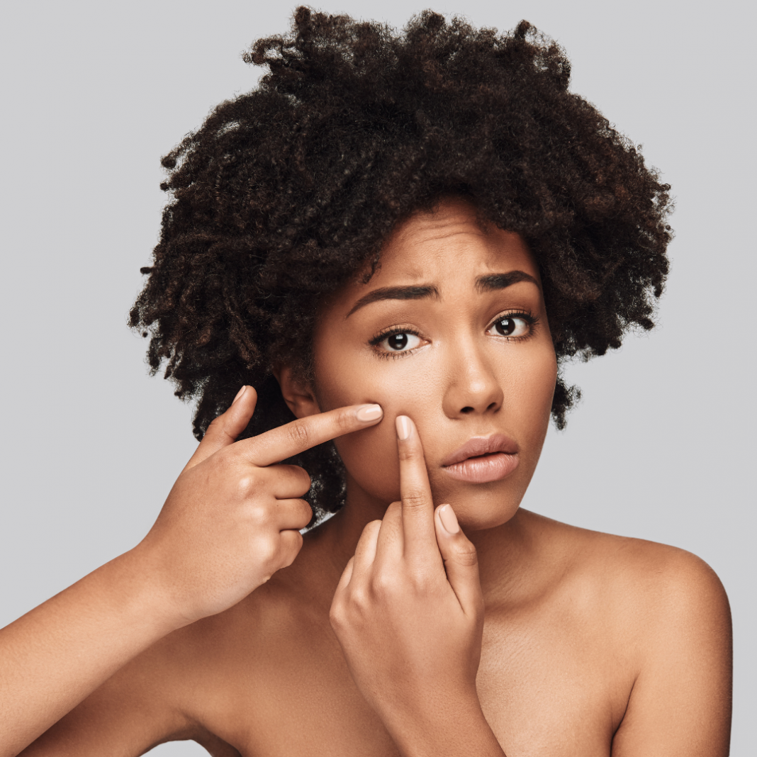 Acne Mapping: What Breakouts In Certain Areas Mean